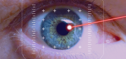 LASIK Eye Surgery: Should You Take the Leap?